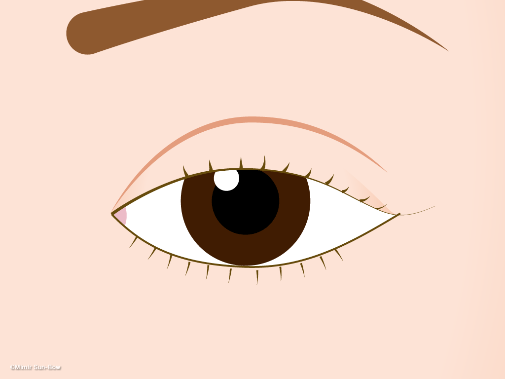 眼瞼下垂のイメージ